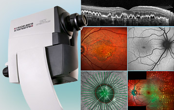 Retinal Screening