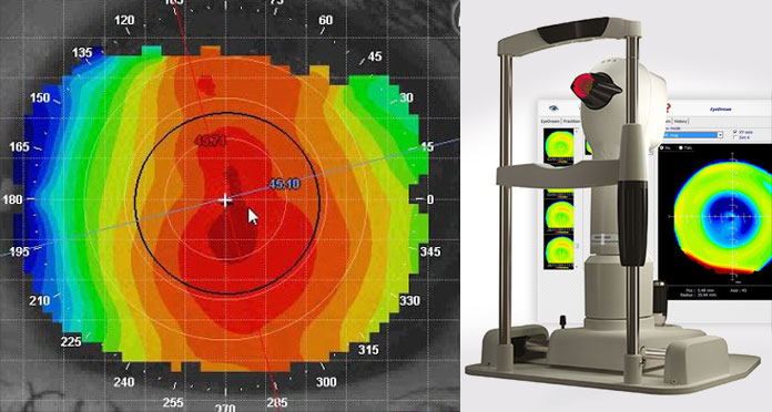 Medmont Corneal Topographer