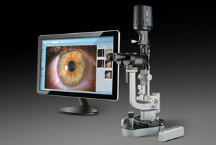 Slit Lamp Image Capture