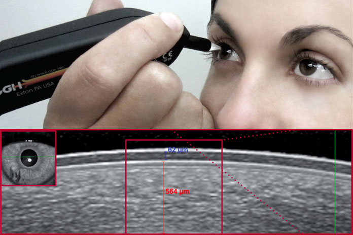 Corneal Pachymetry