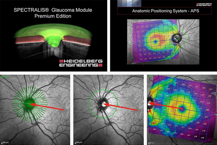 optic nerve imaging