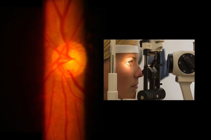 Slit Lamp Examination